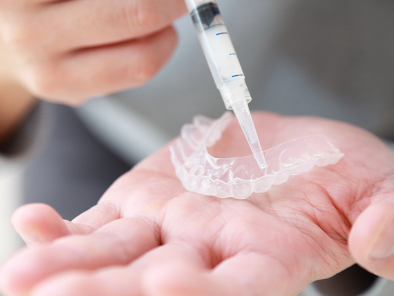 ホームホワイトニング